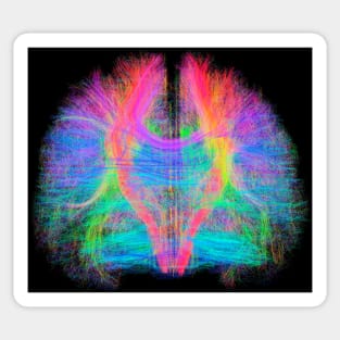 White matter fibres of the human brain (C034/2035) Sticker